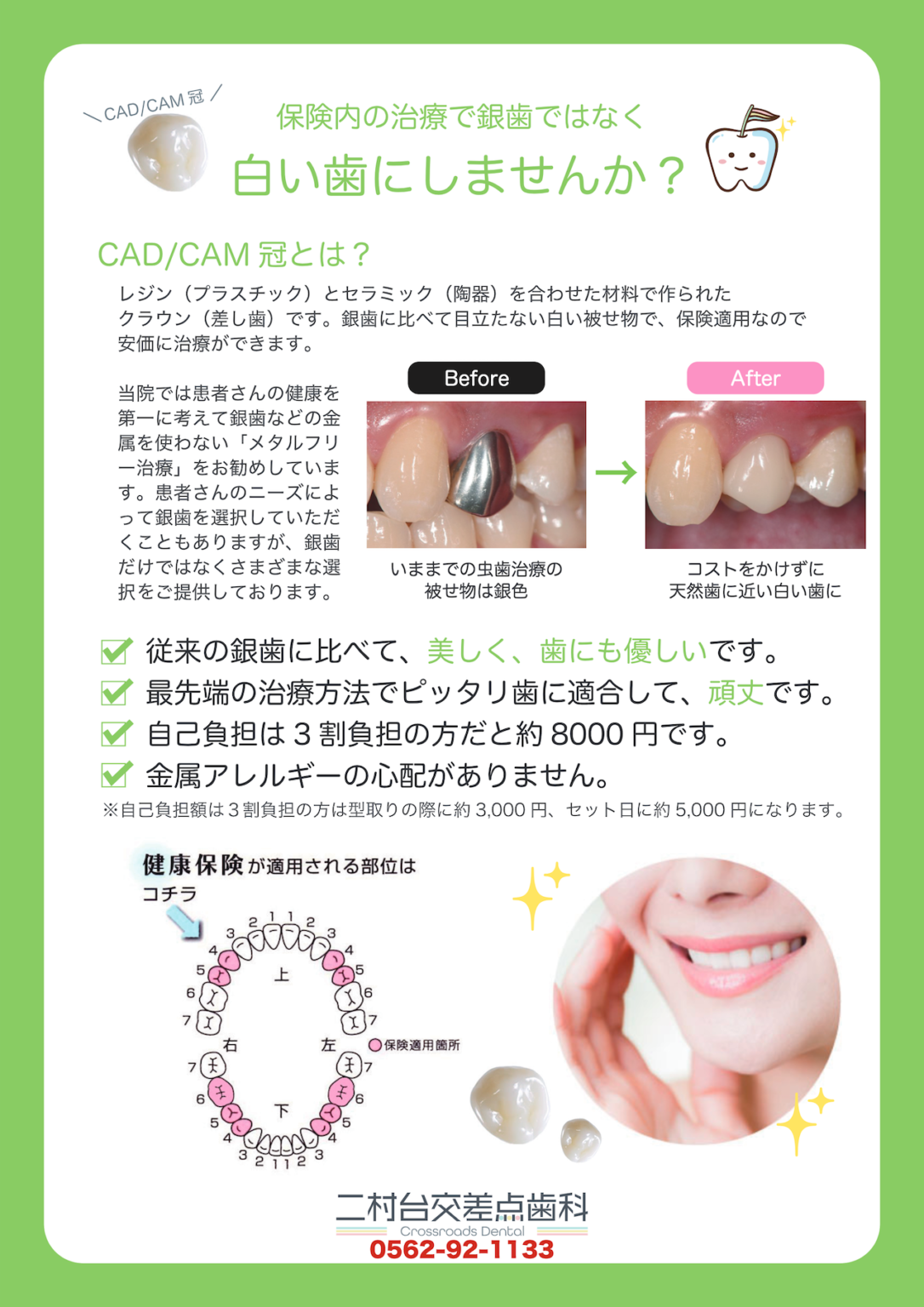 保険内の白い歯のチラシ